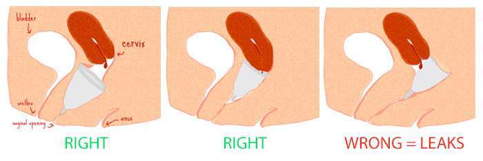 Dónde debería ubicarse tu copa menstrual para ser eficiente