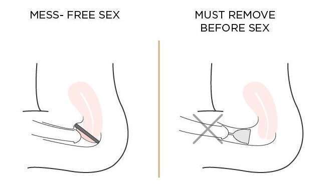 menstrual cup vs menstrual mess free sex 1